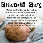 TAGG Organics Tallow Cream for Cradle Cap