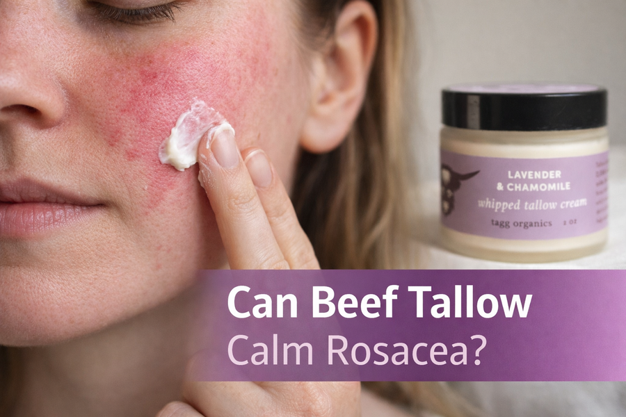 Why Beef Tallow Can Help with Rosacea: The Surprising Benefits for Sensitive Skin