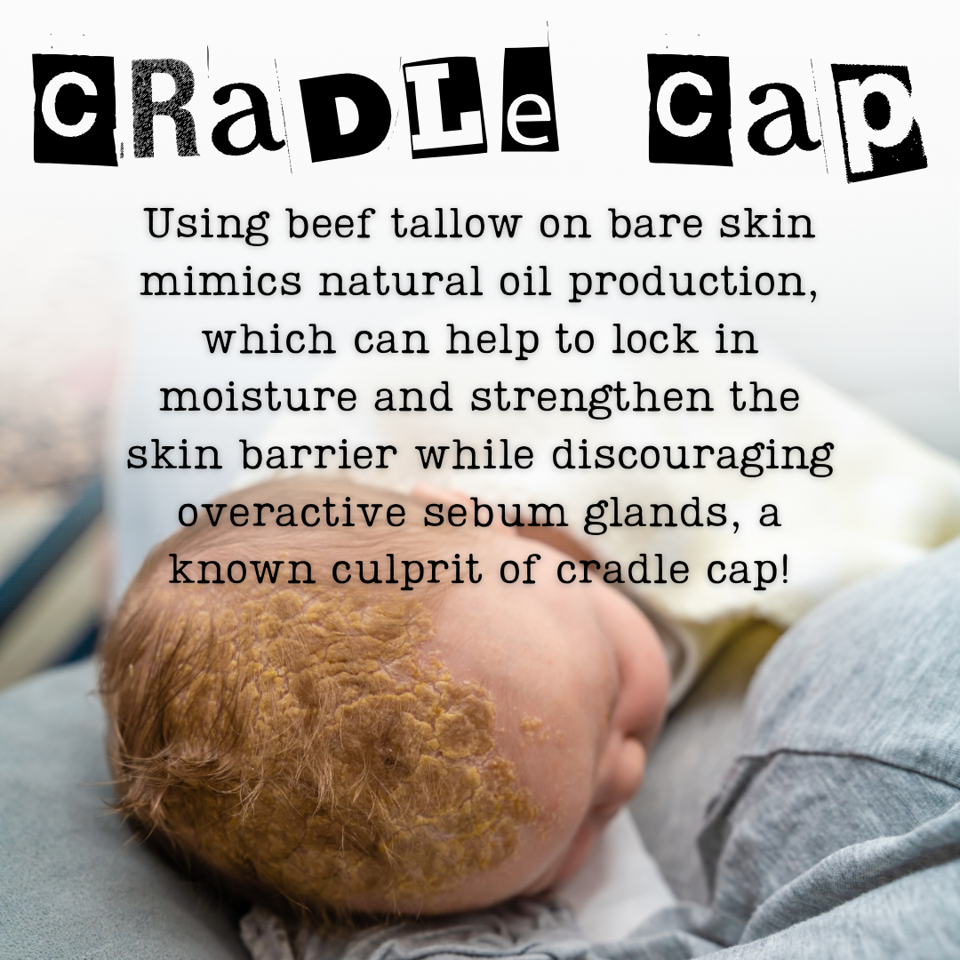TAGG Organics Tallow Cream for Cradle Cap