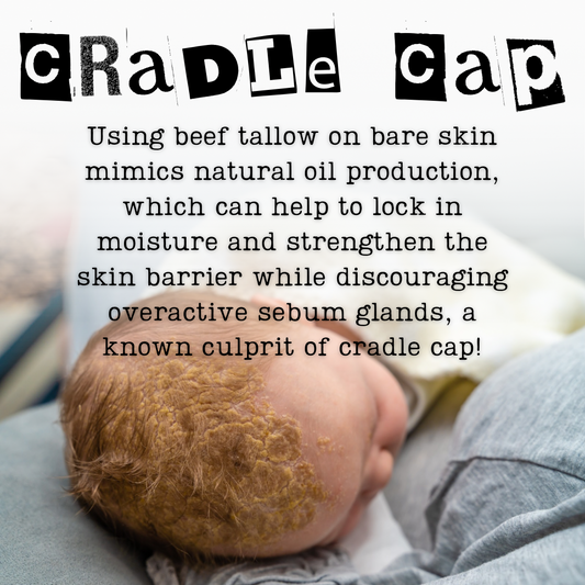TAGG Organics Tallow Cream for Cradle Cap