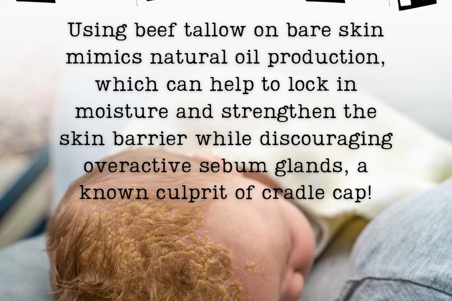 TAGG Organics Tallow Cream for Cradle Cap