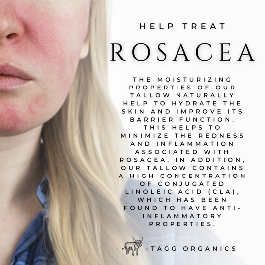 tagg organics tallow benefits for rosacea