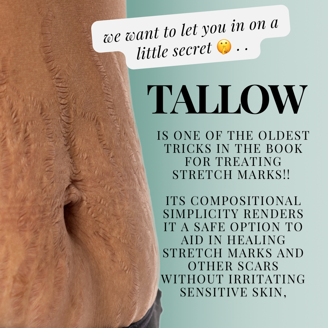 TAGG ORGANICS THE POWER OF TALLOW AGAINST STRETCHMARKS