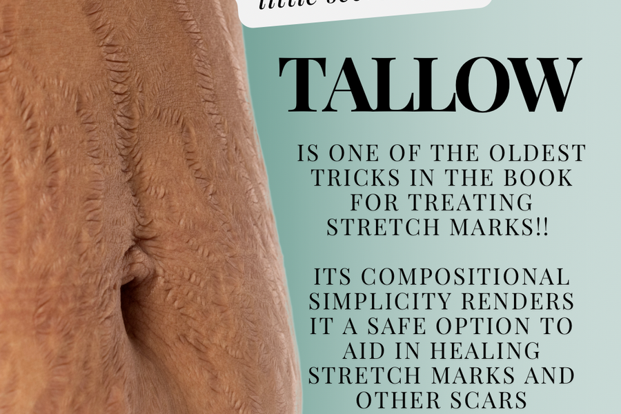 TAGG ORGANICS THE POWER OF TALLOW AGAINST STRETCHMARKS
